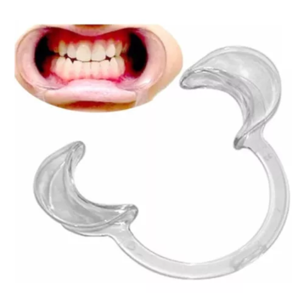 Abreboca Comun