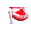 Dispositivo Terapia fotodinámica Dental, implante de esterilización endodóntica, periodontales  